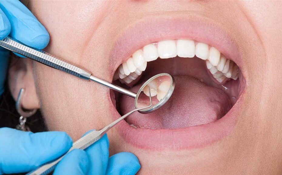 5 اخطاء شائعة تتلف اسنانك "شاهد"