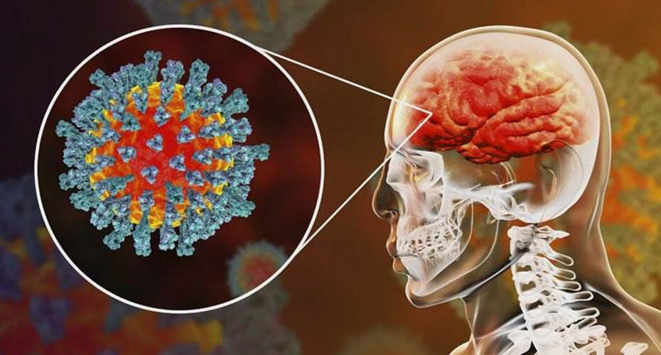 جدل حول تأثير فيروس كورونا على الدماغ