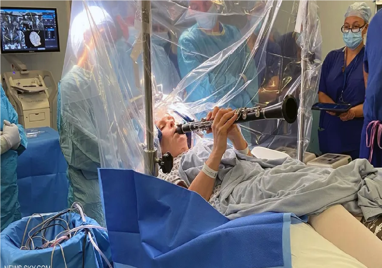 فيديو.. مريضة تعزف الموسيقى أثناء خضوعها لجراحة في الدماغ